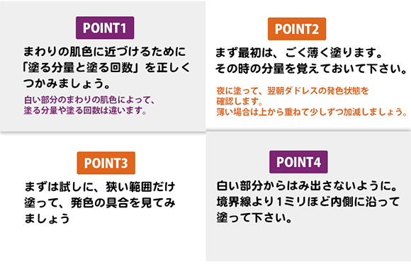 ダドレスおすすめポイント