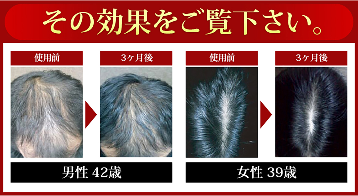 Re;Mou　リモウスカルプローション
